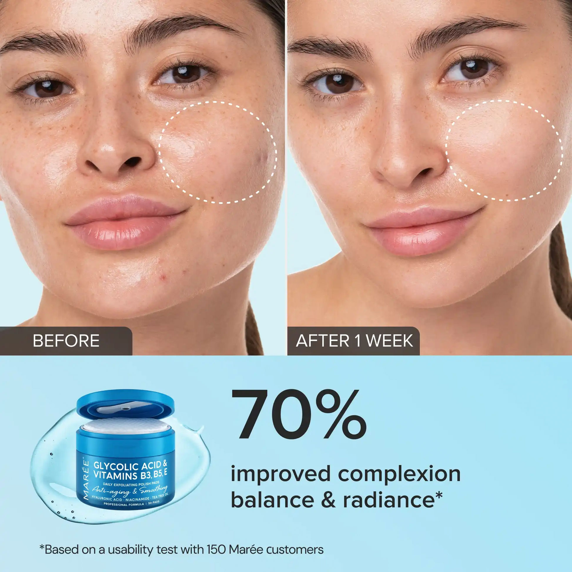 Maree Glycolic Acid Exfoliating Pads - GloMode