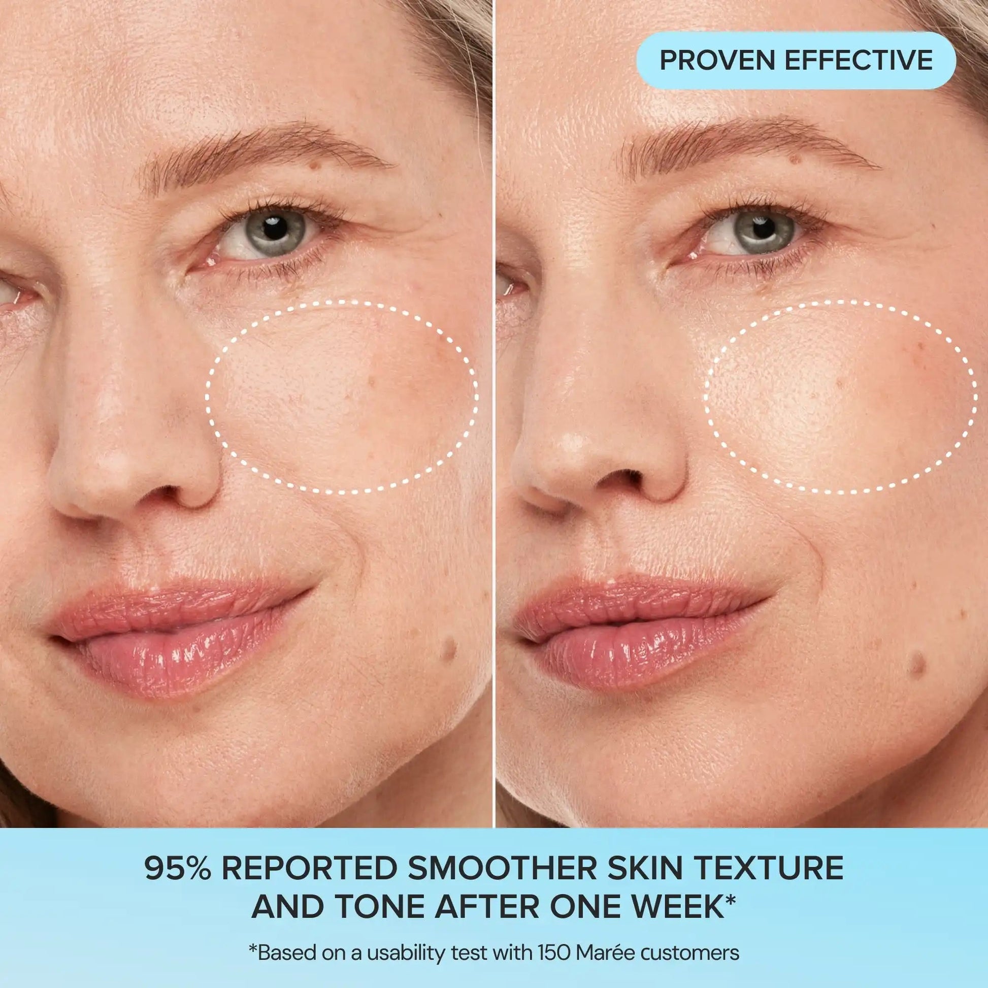 Glycolic Acid Exfoliating Pads - GloMode