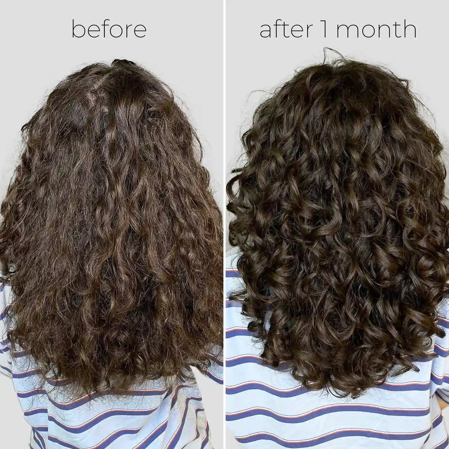 Oil Capsules For Frizzy Hair - GloMode