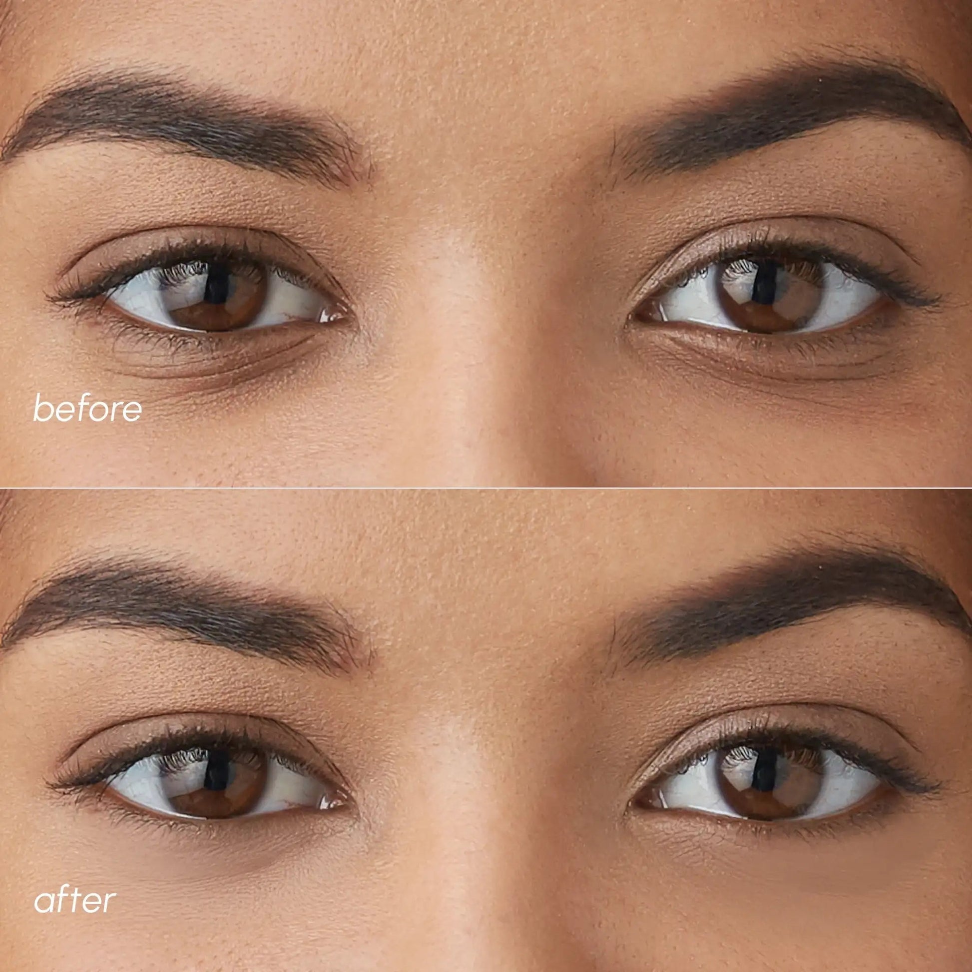 Violet Eye Patches for Dark Circles - GloMode