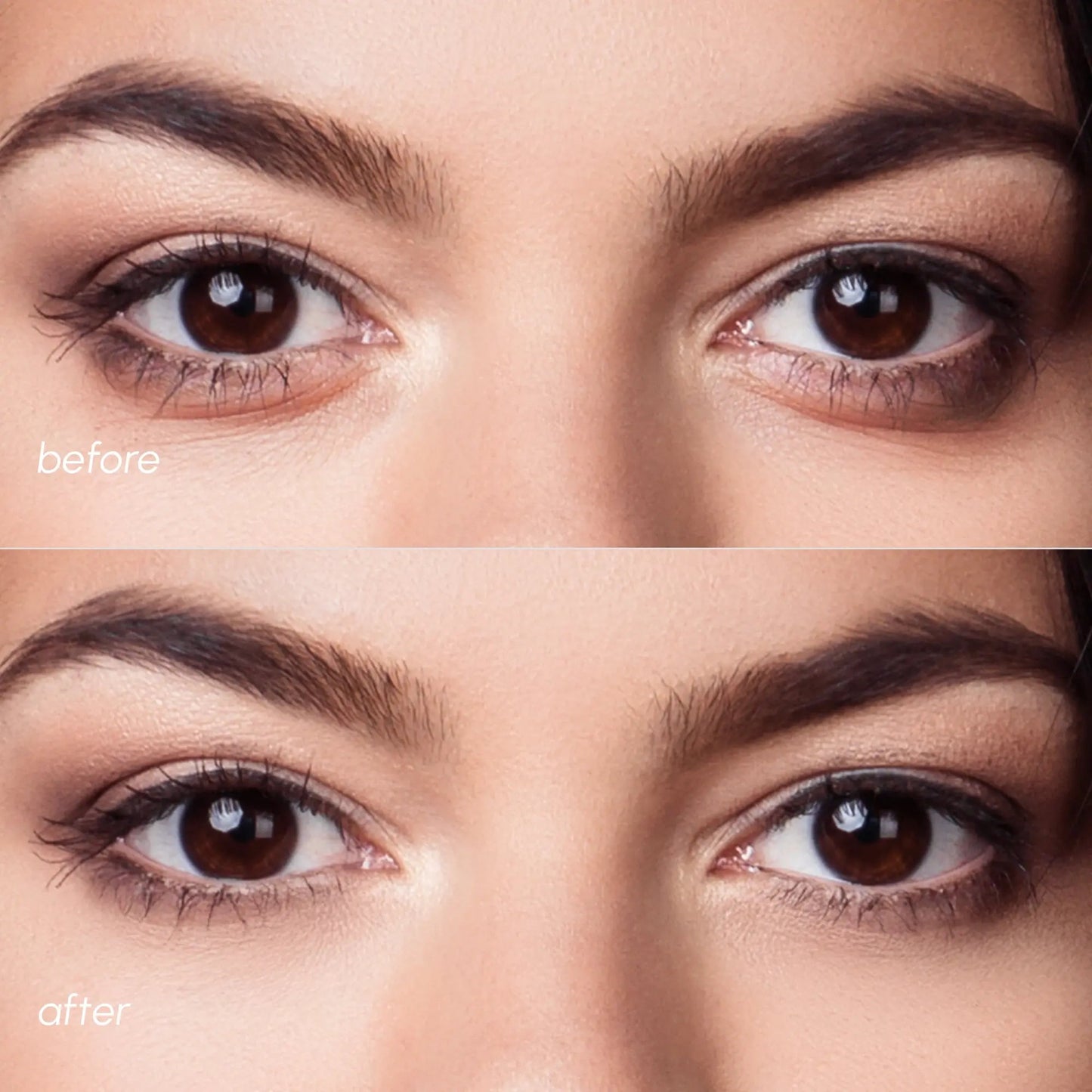 Violet Eye Patches for Dark Circles - GloMode