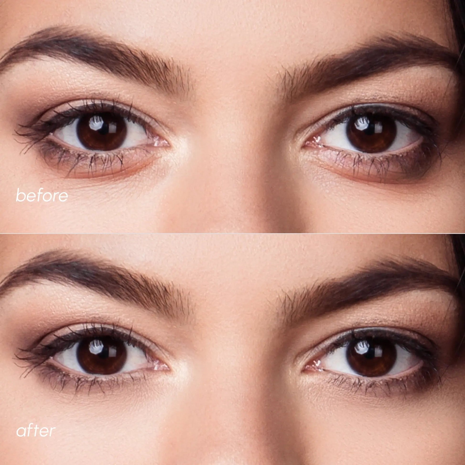 Violet Eye Patches for Dark Circles - GloMode