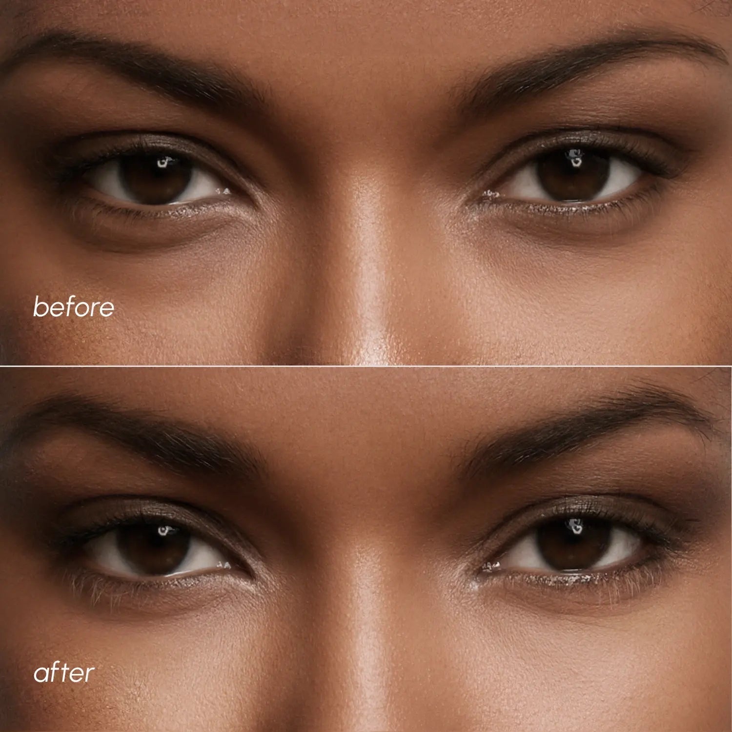 Violet Eye Patches for Dark Circles - GloMode